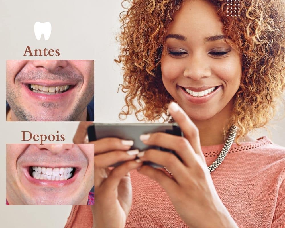Aplicación para blanquear los dientes en la foto 